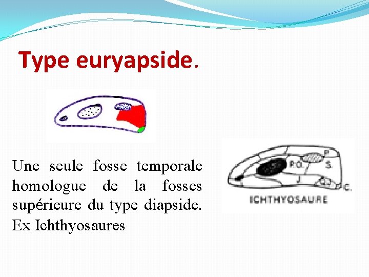 Type euryapside. Une seule fosse temporale homologue de la fosses supérieure du type diapside.