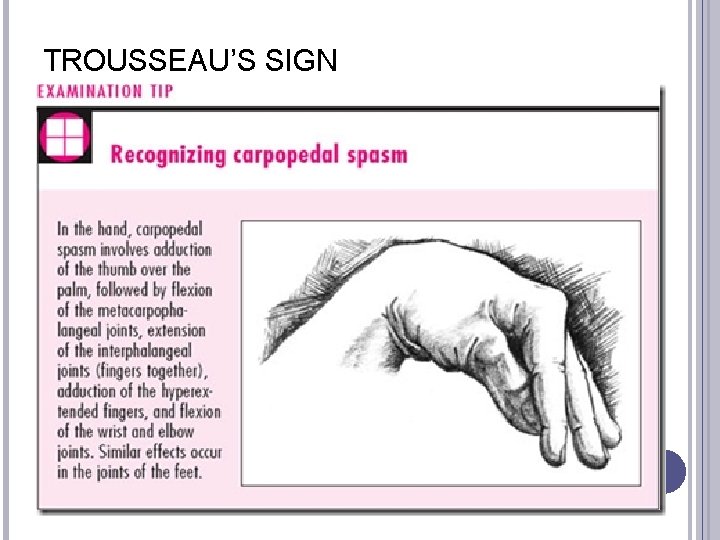TROUSSEAU’S SIGN 