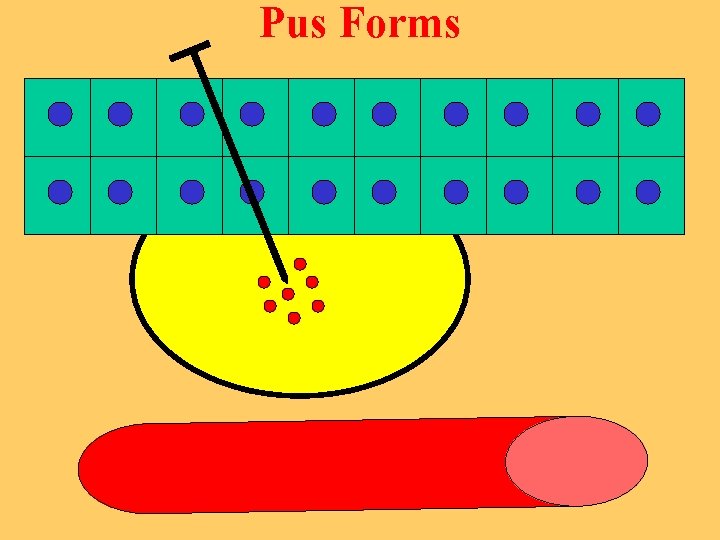 Pus Forms 
