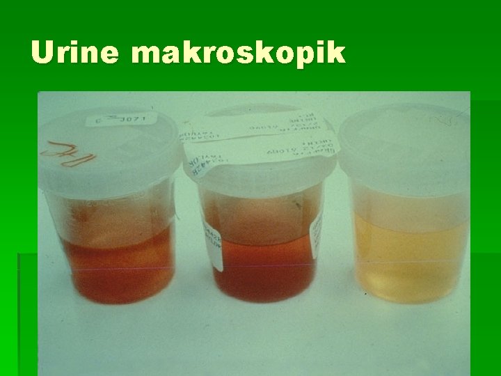 Urine makroskopik 
