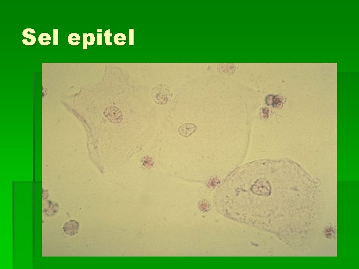 Sel epitel 