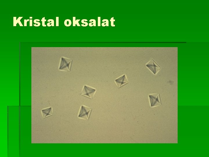 Kristal oksalat 