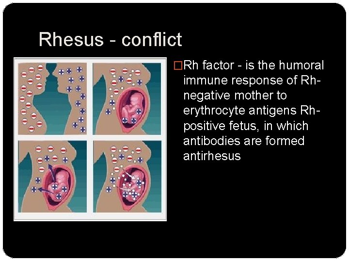 Rhesus - conflict �Rh factor - is the humoral immune response of Rhnegative mother