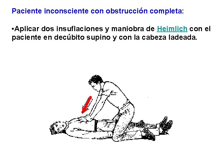 Paciente inconsciente con obstrucción completa: • Aplicar dos insuflaciones y maniobra de Heimlich con