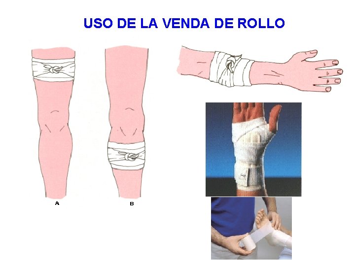 USO DE LA VENDA DE ROLLO 