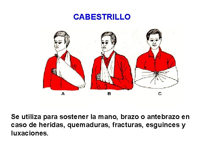 CABESTRILLO Se utiliza para sostener la mano, brazo o antebrazo en caso de heridas,