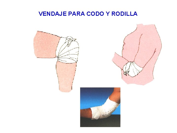 VENDAJE PARA CODO Y RODILLA 