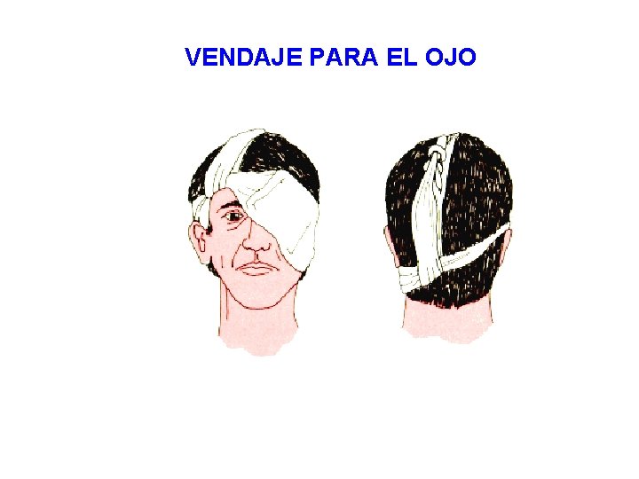 VENDAJE PARA EL OJO 