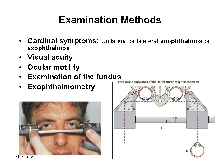 Examination Methods • Cardinal symptoms: Unilateral or bilateral enophthalmos or exophthalmos • • Visual