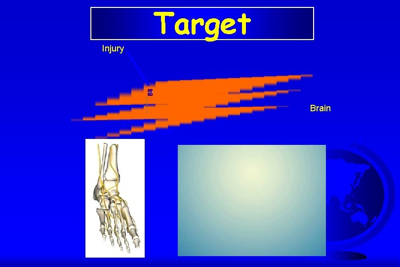 Target Injury Brain Peripheral nerve damage 