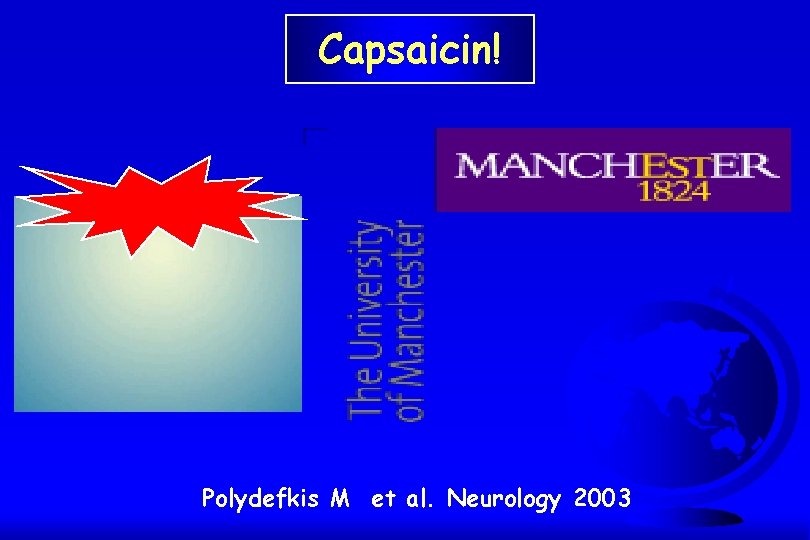 Capsaicin! Polydefkis M et al. Neurology 2003 