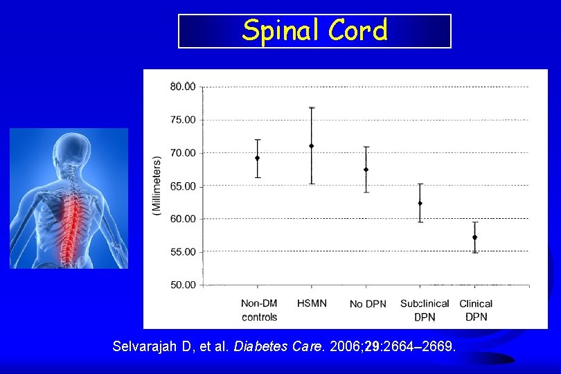 Spinal Cord Selvarajah D, et al. Diabetes Care. 2006; 29: 2664– 2669. 