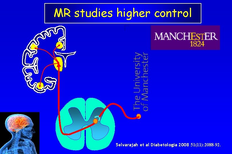 MR studies higher control Selvarajah et al Diabetologia 2008 51(11): 2088 -92. 