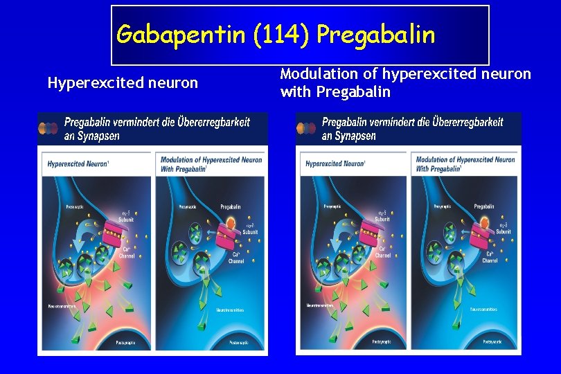 Gabapentin (114) Pregabalin Hyperexcited neuron Modulation of hyperexcited neuron with Pregabalin 