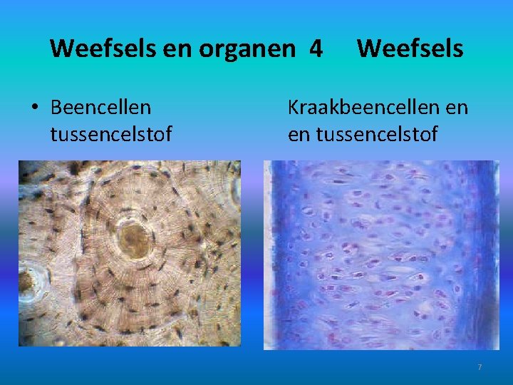 Weefsels en organen 4 • Beencellen tussencelstof Weefsels Kraakbeencellen en en tussencelstof 7 