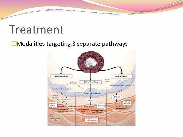 Treatment �Modalities targeting 3 separate pathways 