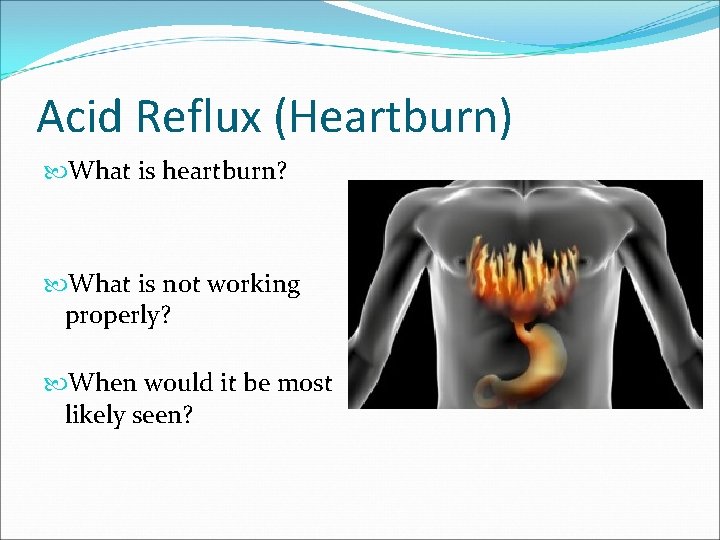 Acid Reflux (Heartburn) What is heartburn? What is not working properly? When would it