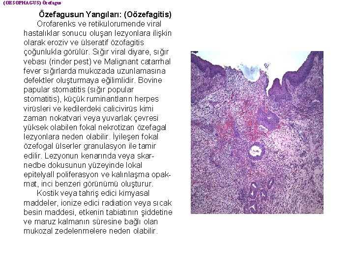 (OESOPHAGUS) Özefagusun Yangıları: (Oözefagitis) Orofarenks ve retikulorumende viral hastalıklar sonucu oluşan lezyonlara ilişkin olarak