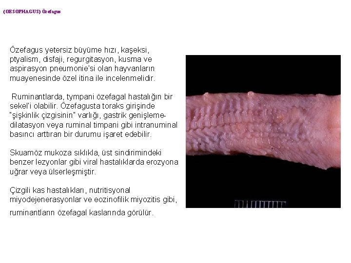 (OESOPHAGUS) Özefagus yetersiz büyüme hızı, kaşeksi, ptyalism, disfaji, regurgitasyon, kusma ve aspirasyon pneumonie’si olan