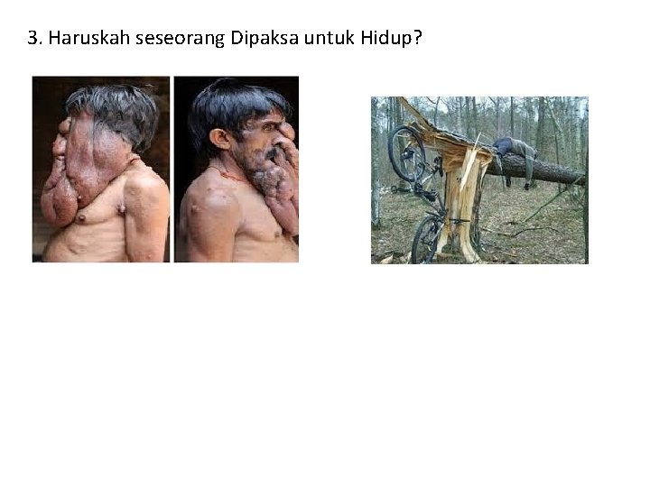 3. Haruskah seseorang Dipaksa untuk Hidup? 