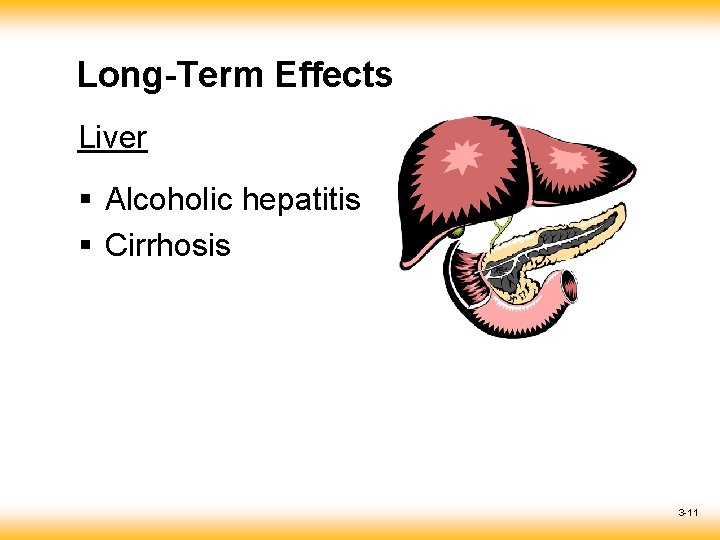 Long-Term Effects Liver § Alcoholic hepatitis § Cirrhosis 3 -11 