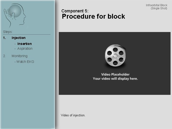Component 5: Procedure for block Steps: 1. Injection - Insertion - Aspiration 2. Monitoring
