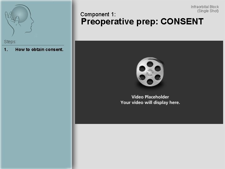 Component 1: Infraorbital Block (Single Shot) Preoperative prep: CONSENT Steps: 1. How to obtain