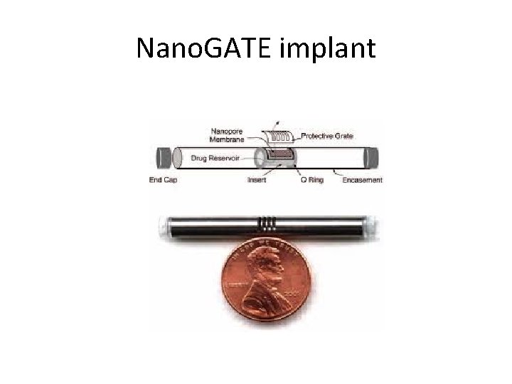 Nano. GATE implant 