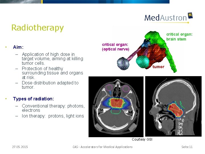 Radiotherapy • critical organ: brain stem critical organ: (optical nerve) Aim: – Application of