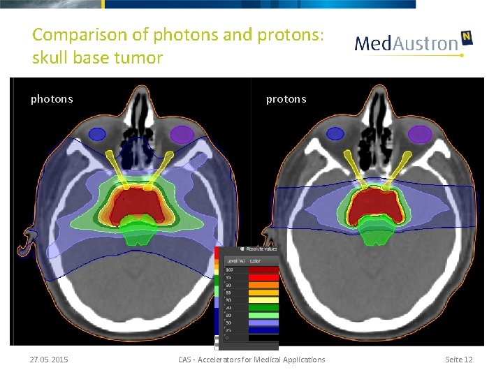 Comparison of photons and protons: skull base tumor photons 27. 05. 2015 protons CAS