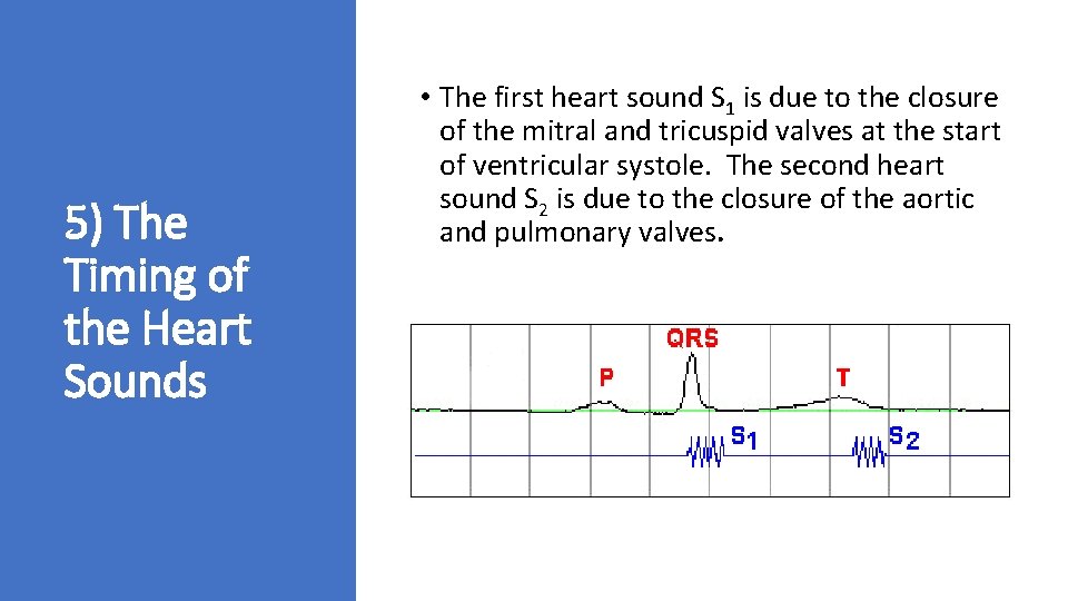 5) The Timing of the Heart Sounds • The first heart sound S 1