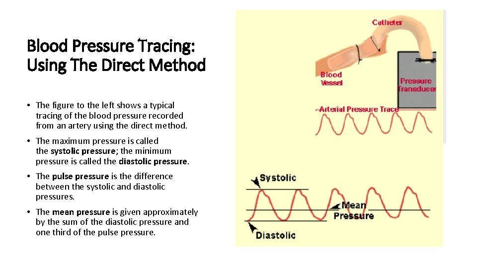 Blood Pressure Tracing: Using The Direct Method • The figure to the left shows