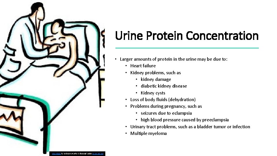 Urine Protein Concentration • Larger amounts of protein in the urine may be due
