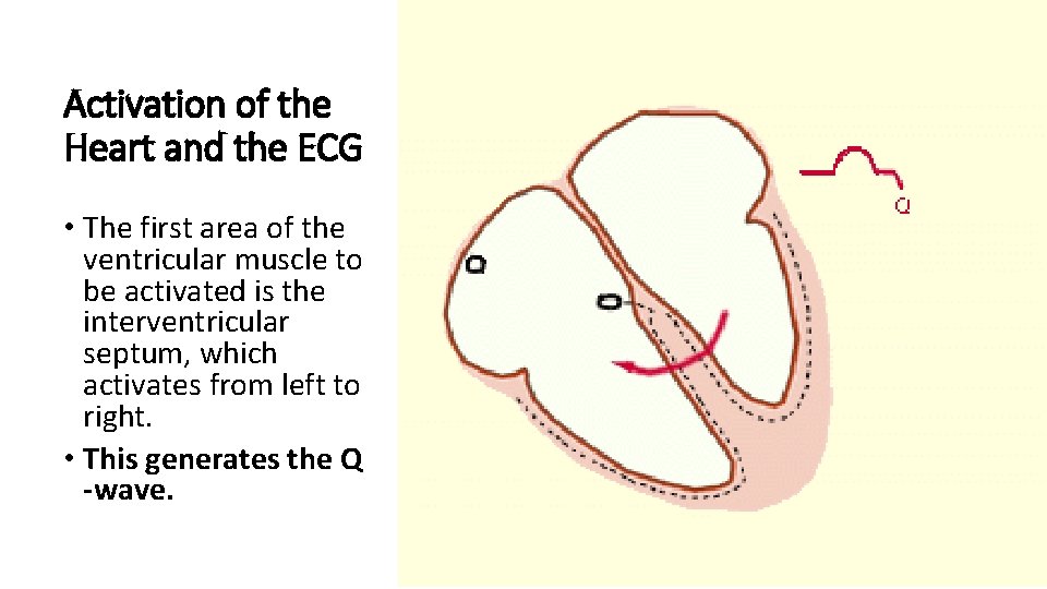 Activation of the Heart and the ECG • The first area of the ventricular
