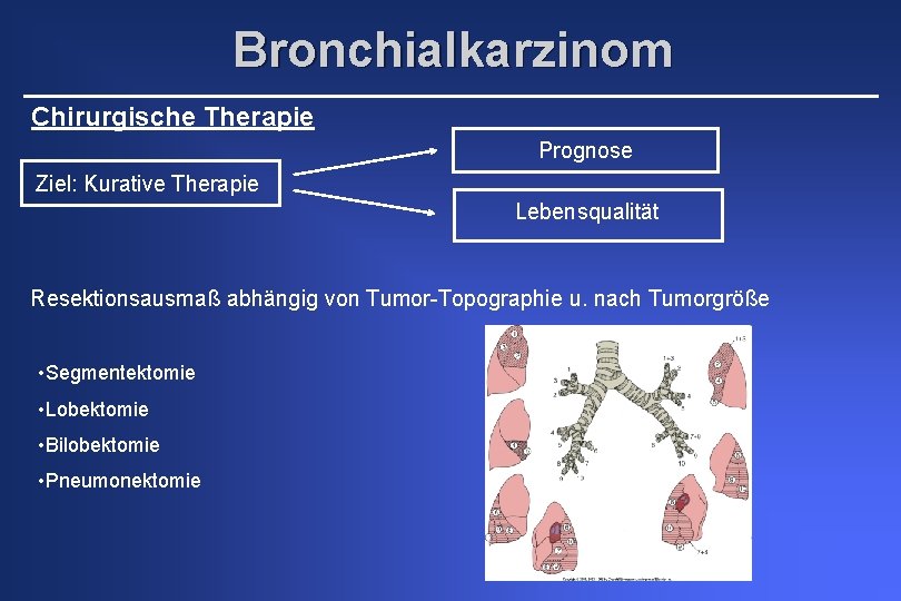 Bronchialkarzinom Chirurgische Therapie Prognose Ziel: Kurative Therapie Lebensqualität Resektionsausmaß abhängig von Tumor-Topographie u. nach