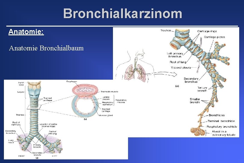 Bronchialkarzinom Anatomie: Anatomie Bronchialbaum 