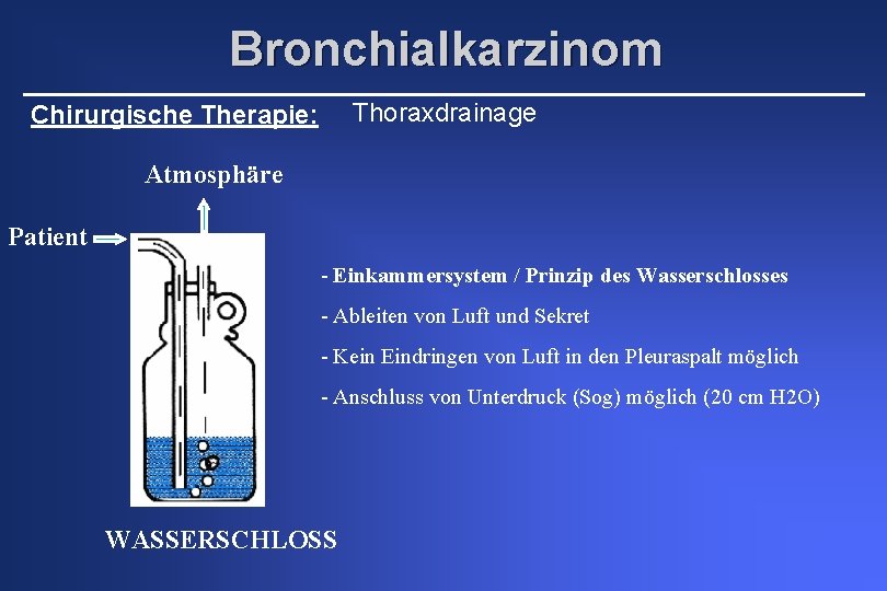 Bronchialkarzinom Thoraxdrainage Chirurgische Therapie: Atmosphäre Patient - Einkammersystem / Prinzip des Wasserschlosses - Ableiten