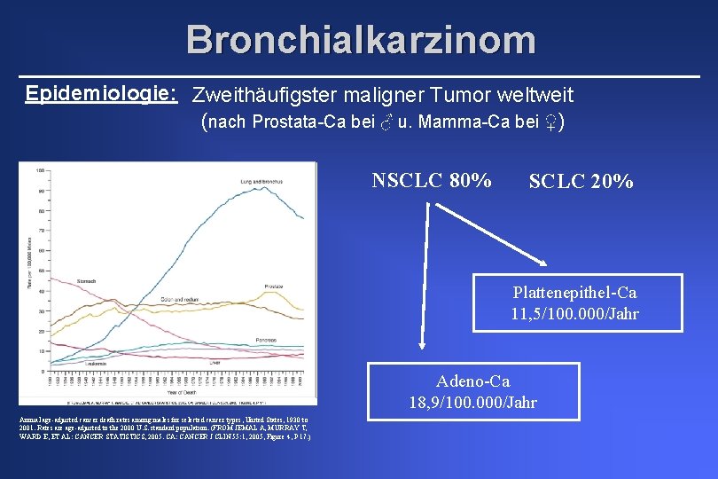 Bronchialkarzinom Epidemiologie: Zweithäufigster maligner Tumor weltweit (nach Prostata-Ca bei ♂ u. Mamma-Ca bei ♀)