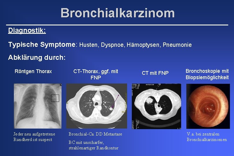 Bronchialkarzinom Diagnostik: Typische Symptome: Husten, Dyspnoe, Hämoptysen, Pneumonie Abklärung durch: Röntgen Thorax CT-Thorax, ggf.