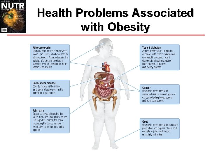 Health Problems Associated with Obesity 