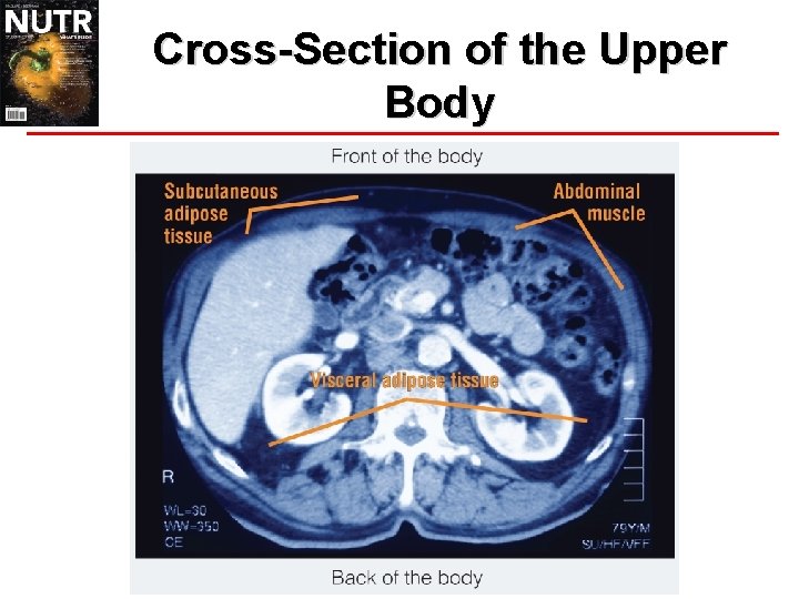 Cross-Section of the Upper Body 