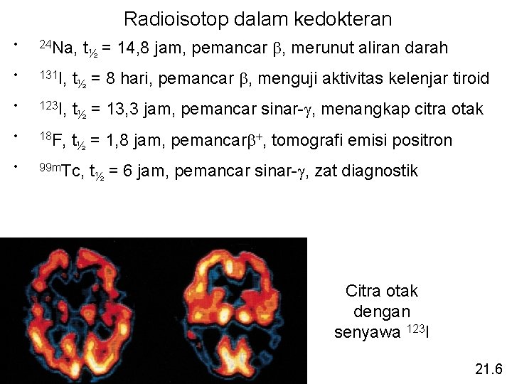 Radioisotop dalam kedokteran t½ = 14, 8 jam, pemancar b, merunut aliran darah •