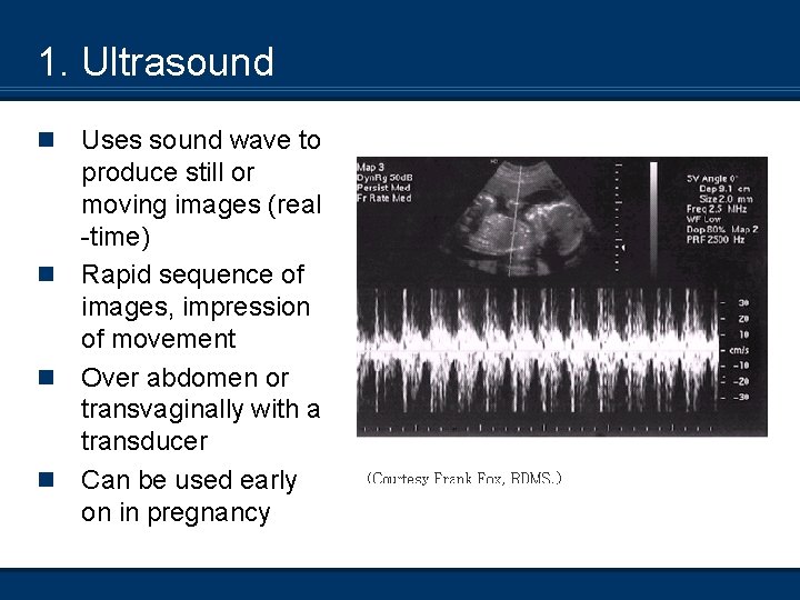 1. Ultrasound n n Uses sound wave to produce still or moving images (real