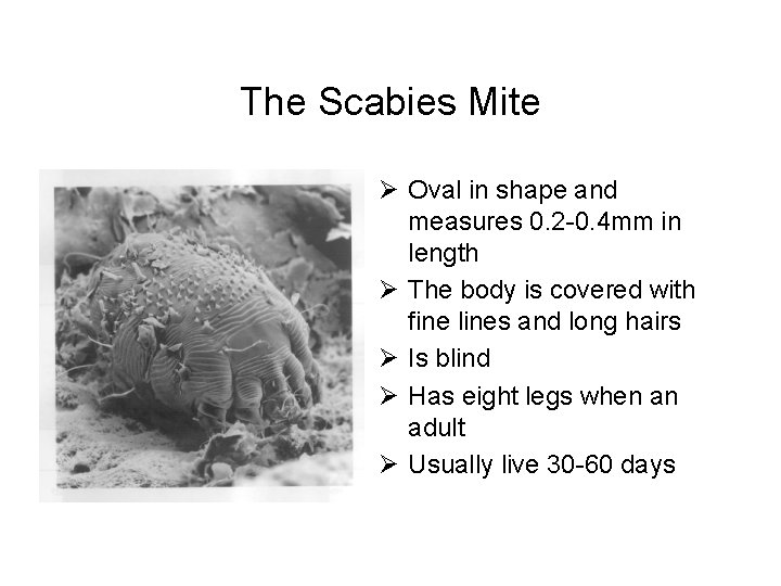 The Scabies Mite Ø Oval in shape and measures 0. 2 -0. 4 mm