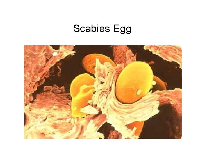 Scabies Egg 