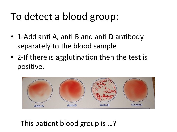 To detect a blood group: • 1 -Add anti A, anti B and anti