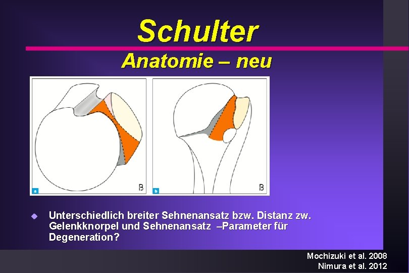 Schulter Anatomie – neu u Unterschiedlich breiter Sehnenansatz bzw. Distanz zw. Gelenkknorpel und Sehnenansatz