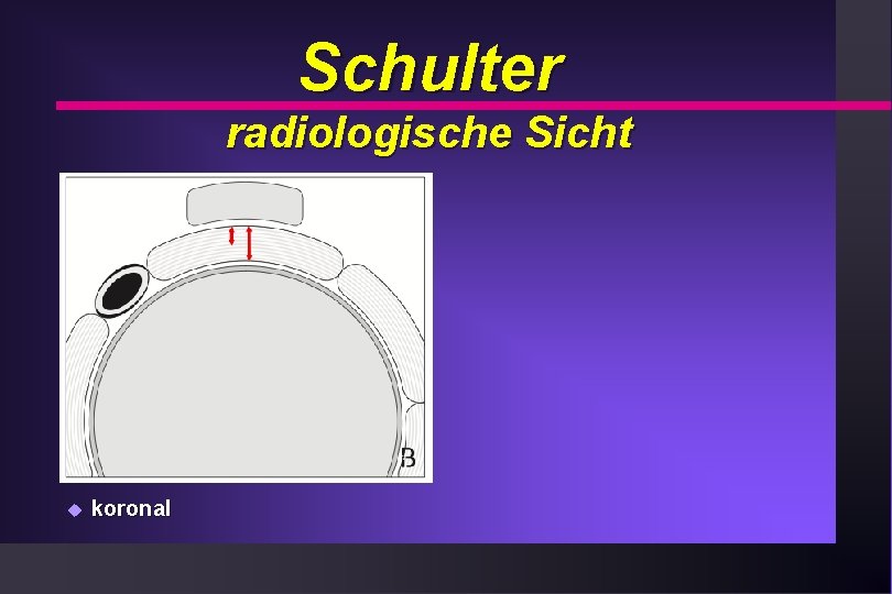 Schulter radiologische Sicht u koronal 