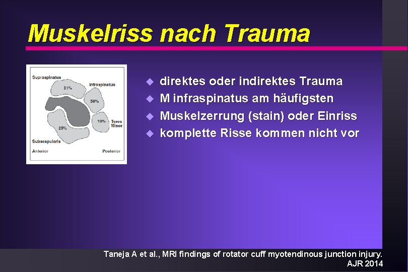 Muskelriss nach Trauma u u direktes oder indirektes Trauma M infraspinatus am häufigsten Muskelzerrung