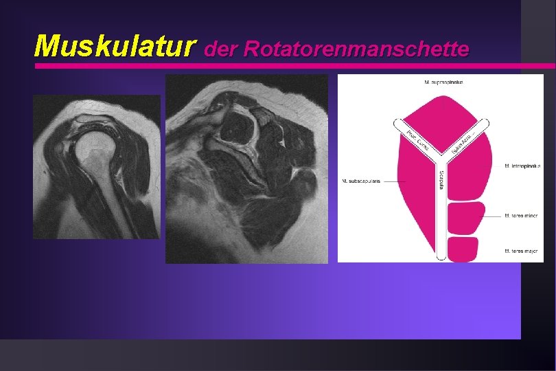 Muskulatur der Rotatorenmanschette 